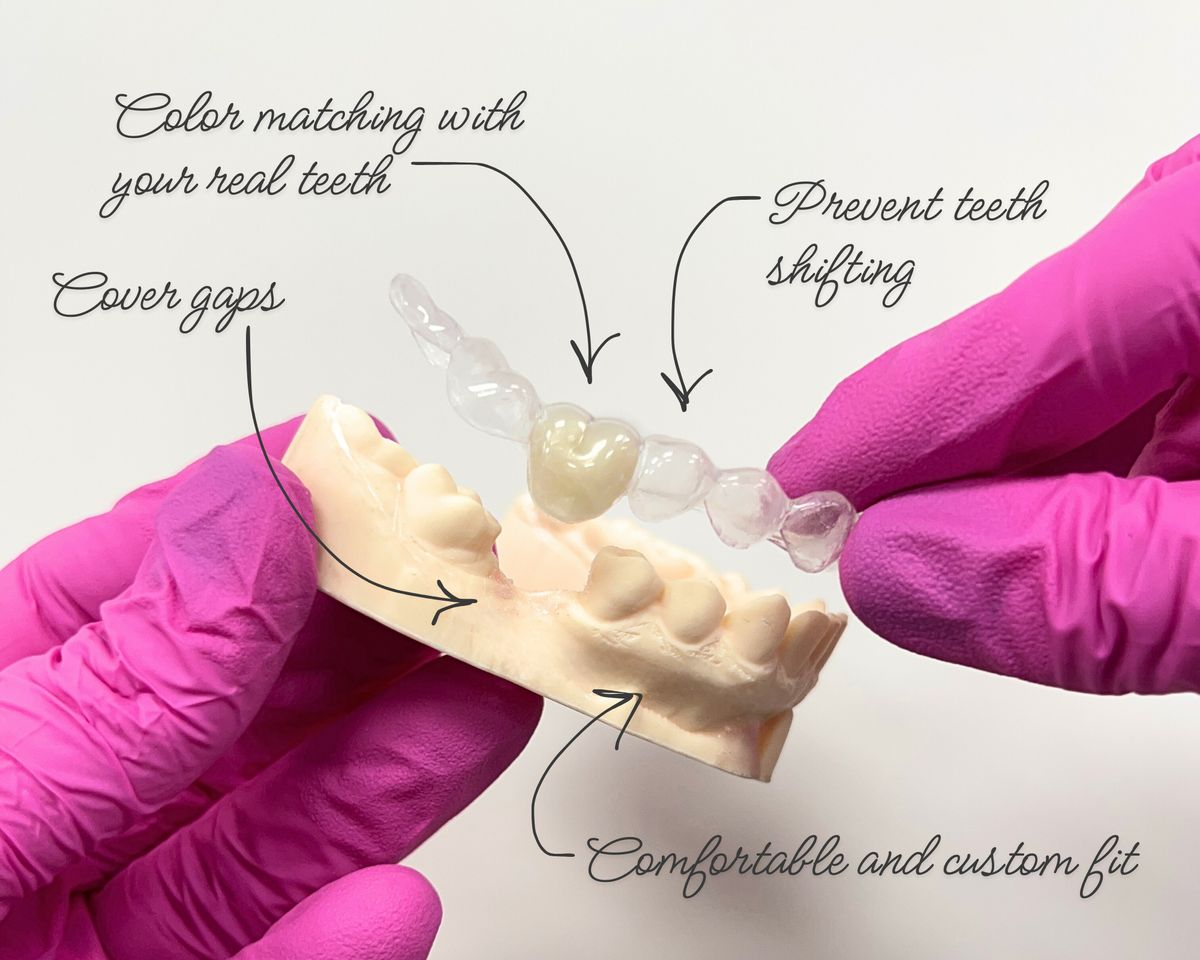 Dental Retainers