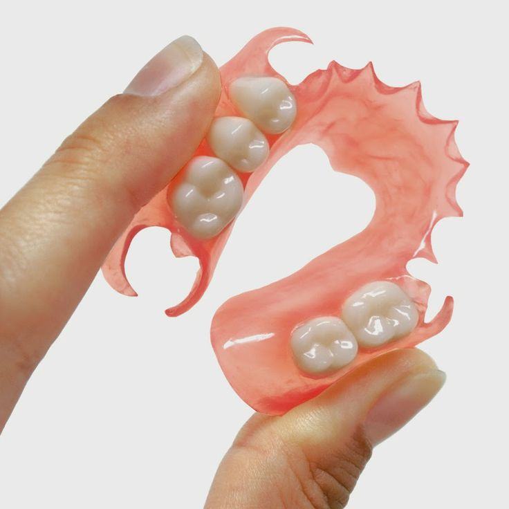 Flexible Dentures — lightweight, gum-coloured and metal-free for a discreet fit.